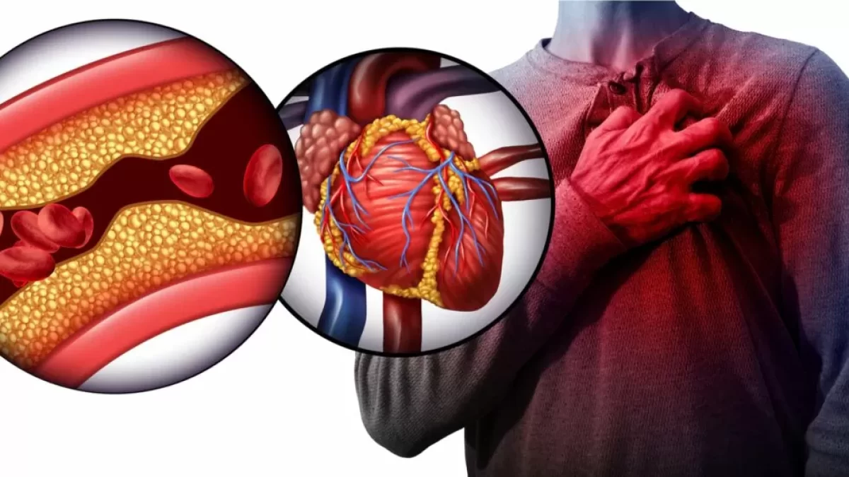 Triglicéridos Altos y Su Relación con Tu Salud Cardíaca